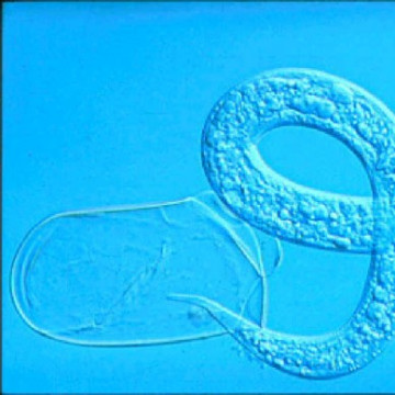 A kertészeti növények kártevői I.